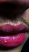 4 Vermilion Border Spikes (top lip)