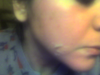 face.3rd day green peel