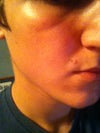 Picture of the problem
