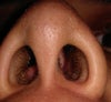 both nostrils as best as could do without it getting blurry.