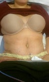 this is taken on day for. Now my lower part is very pouched out.