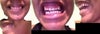 My teeth.