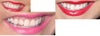 How I want my teeth to look.