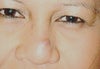 Thats my mole, on my right upper nose