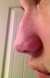 Side #2