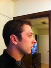 Before side