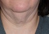 Neck