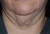 another neck picture