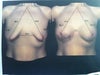 picture 3d of my actual breast and chest measurements, and the possible look after implants  and lift