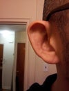 Just a minor procedure to create a fold
