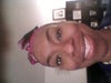 This is a forward facing shot with my phone, so its actually my right eye  that is smaller.