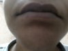 my ugly wide mouth..... plz help me