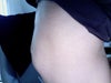 Side view of my stomach 5 years post surgery.