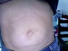 front view of my stomach