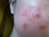 i want to repair my skin pls help