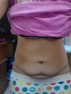 1 year very slightly bent over.