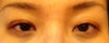 I think it's causing my left eyebrow to go up!