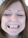 my teeth