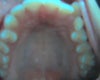 This is my upper jaw and you can see my canine and my baby tooth.