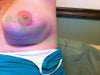 left arm raised close up