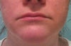 Downturned lips