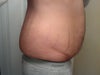 Taken 10 pounds heavier than I am now. Stretch marks on my side and abdomen.