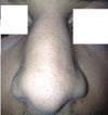 nose when relaxed
