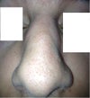 nose when i scrunch up