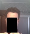 One week after. I just took of the head band.