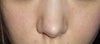 Is glycation partly to blame? How can I reverse this?