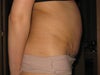 7 weeks after TT