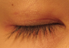 closed eye