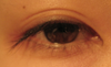 eye opened a little further