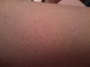 my leg