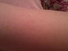 my arm