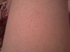 my  thigh