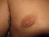 right nipple nearly flat