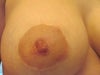 Areola to be re-sized