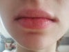 my lips