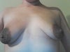 areola larger than actual breast