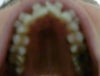 birds eye view of upper narrow arch
