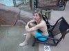 9 months pre op - surgery completely changed my appearance.