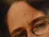 this is before. right side of forehead is totally smooth at rest, no vertical lines above right brow.