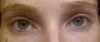 Eyes on day 2