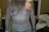 Yes the left boob is square?  It just seems like this is a nightmare going on and on and on!