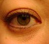 purple rings under eyes, looks more purple in person