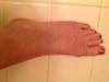 See the veins across the middle portion of the top of my foot.