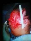 This is before any surgeries