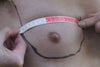 Right Breast outlined