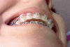 smiling profile